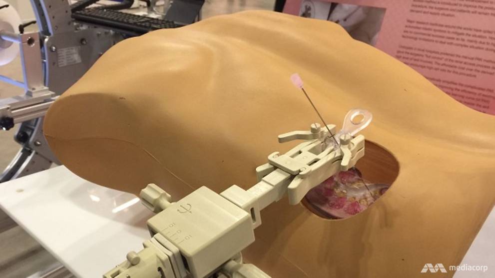 Team of ITE staff develops device to simplify kidney stones removal